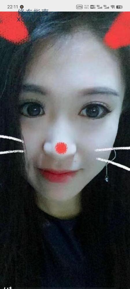 沈阳再战福尔阳光清肤泉会馆燕子